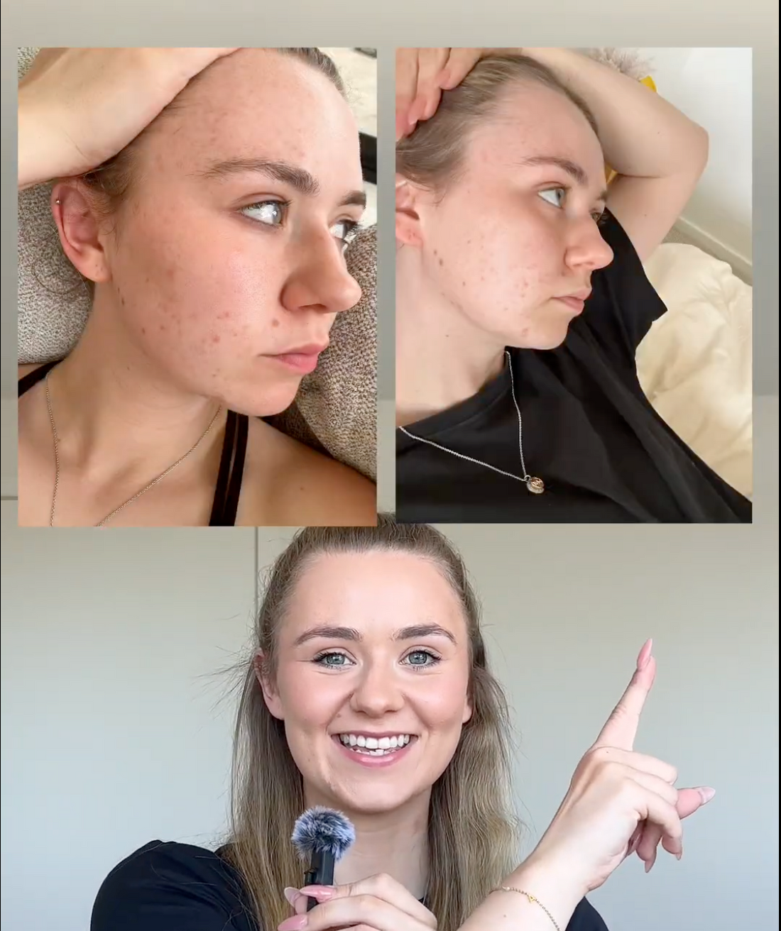 before and after photos